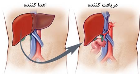 درمان هپاتیت اتو ایمیون