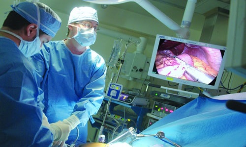 جراحی برداشتن کیسه صفرا با روش لاپاراسکوپی